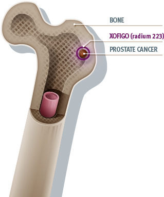 Bone